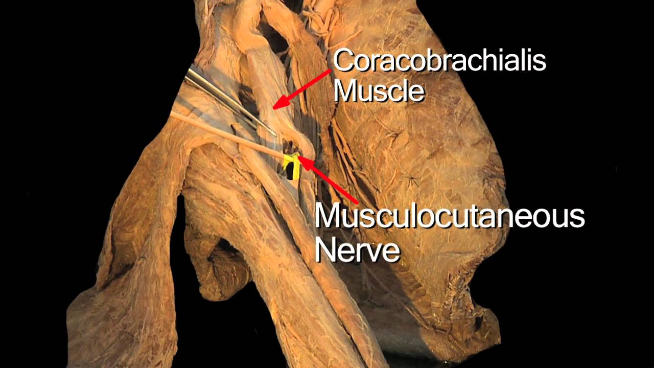 The Anterior Arm - Anatomy Tutorial - YouTube