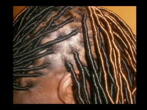 Beeper Braids | beeper braids alternative to locs bh4u youtube Beeper Braids | beeper braids alternative to locs bh4u youtube