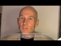 B12 Deficiency