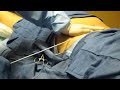 Video: SmartLipo-Laser Liposuction-Abdomen-Love Handles-Valley Aesthetics