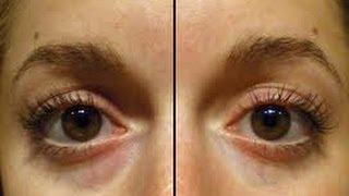 Elimina las Ojeras y las BOLSAS de los ojos con LECHE Y CÚRCUMA / Get Rid of Dark Circles