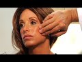 Video: Silhouette Lift Consultation with Dr. Andre Berger