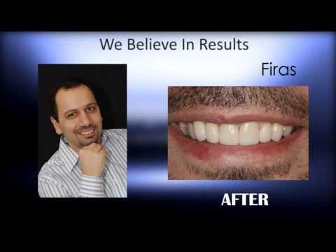 Best Dentist Wellesley 781.772.1646 - Mind Blowing Results Dentist in Wellesley MA