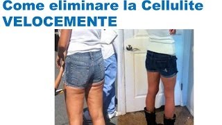 Come eliminare la cellulite con cellulite rimedi naturali e dieta anticellulite; creme anticellulite