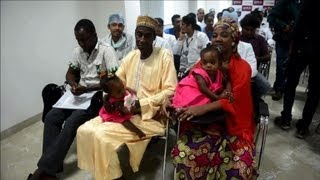 Conjoined Nigerian twins successfully separated in India