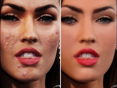 Home treatments for zits and pimples murad acne evaluations