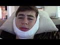 WISDOM TEETH - Nash Grier