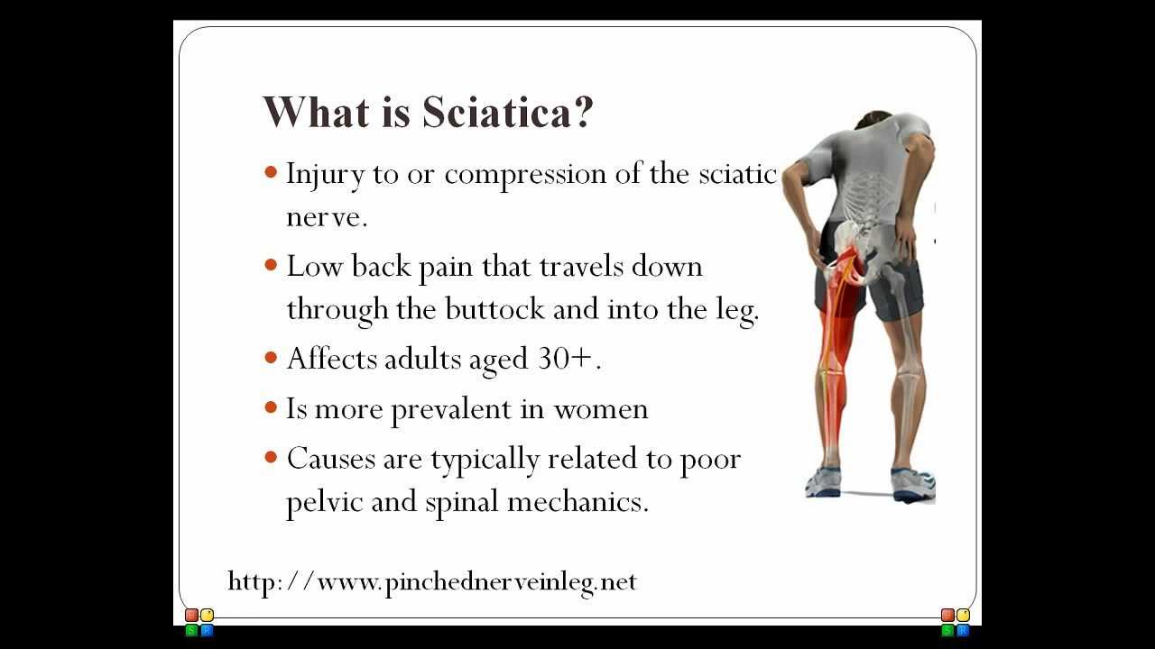 Pinched Nerve In Leg - YouTube
