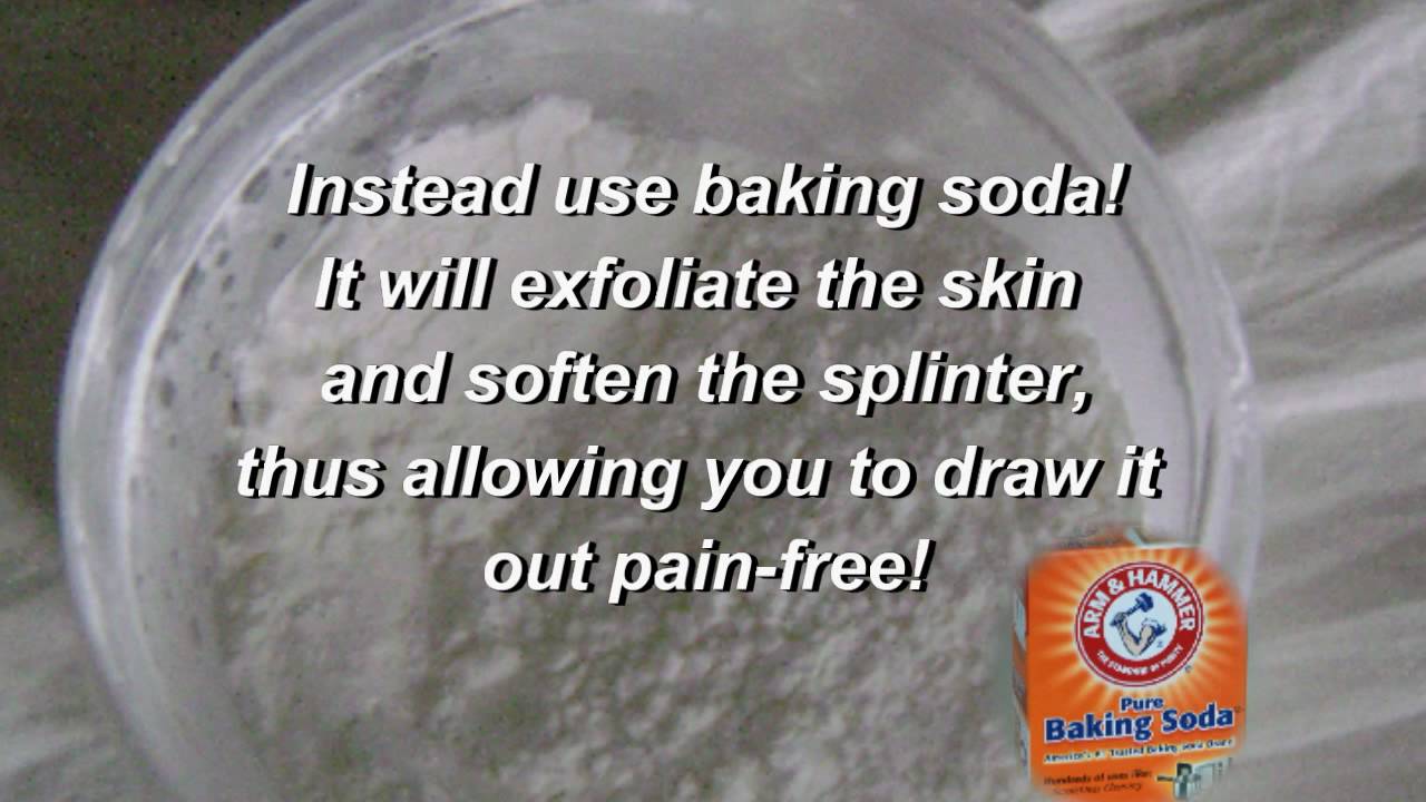 Passing It On: Removing a Splinter with Baking Soda! - YouTube