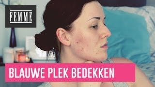 Blauwe plekken bedekken - FEMME