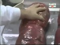 Viande reconstituée , malbouffe