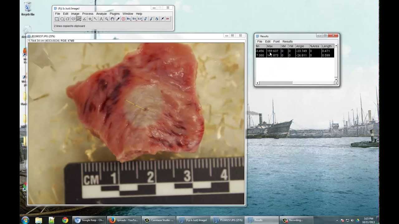 Measuring Images with ImageJ (FIJI) - YouTube