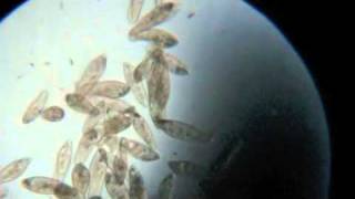 Paramecium Under the Microscope