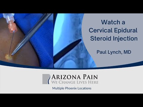 Herniated disc steroid injection risks