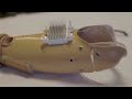 This prosthetic helps amputees feel the warmth of human touch | REUTERS  - 01:49 min - News - Video