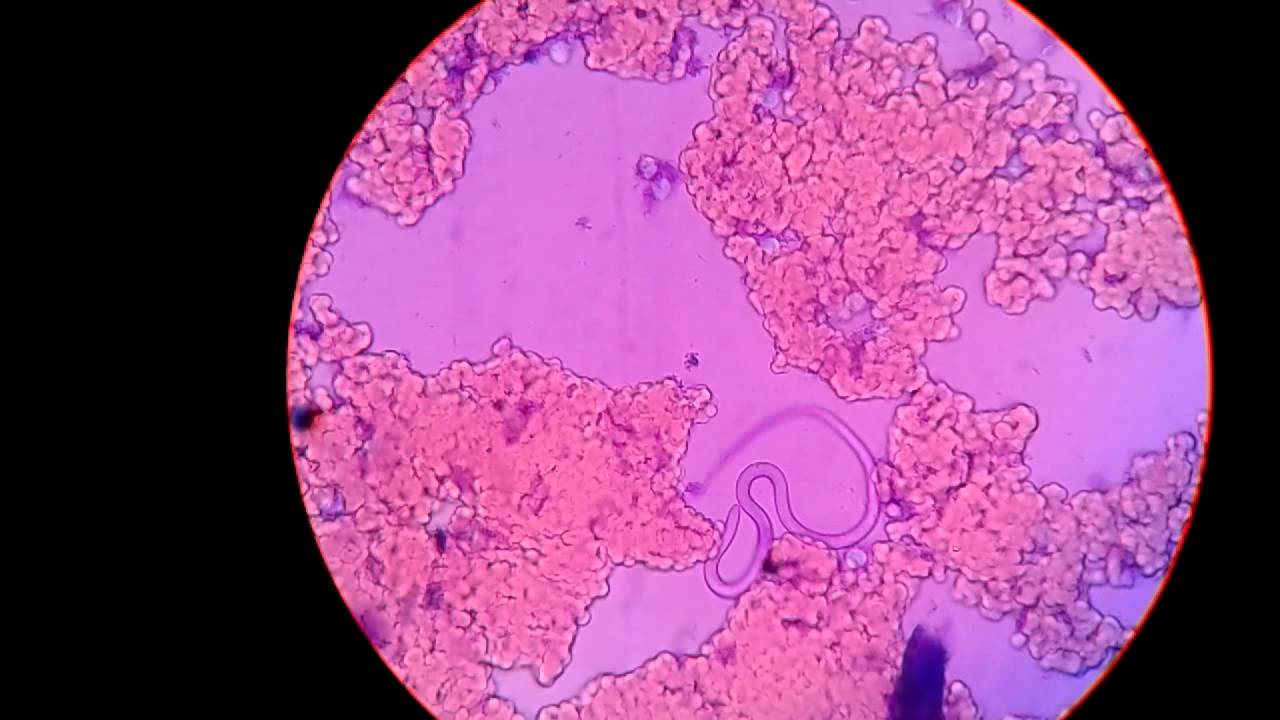 Live Microfilaria Parasite In Blood Under Microscope Captured In My Camera Youtube