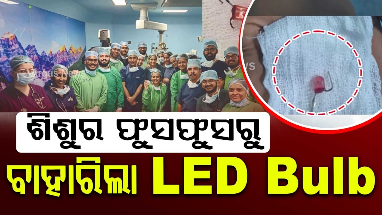 KIMS Doctors Remove LED Bulb From 4-Year-Old Child's Lung Without Major Surgery | Argus News