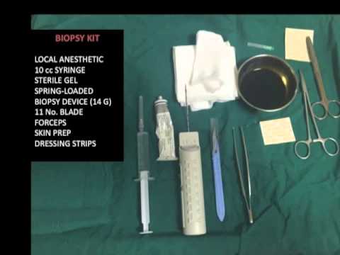 Ultrasound guided core breast biopsy Words... sorry, Ultrasound guided core breast biopsy opinion