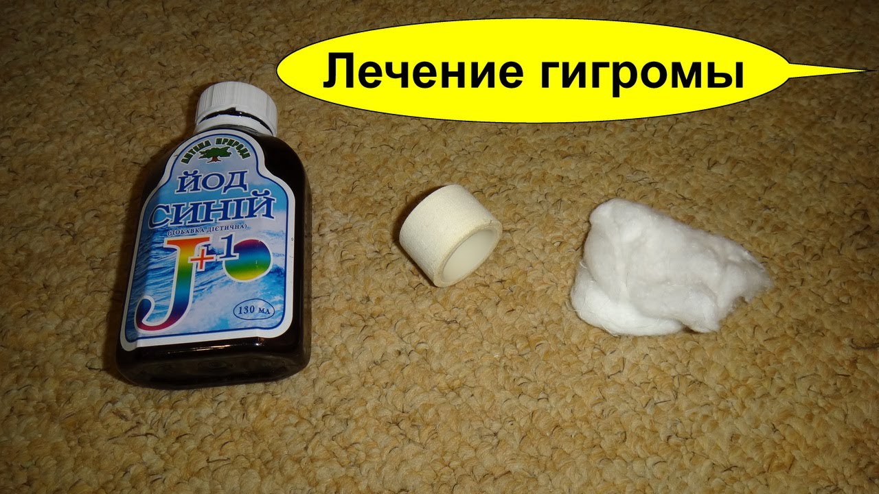 Гигрома Сустава Лечение Мази — Buy-artox.ru