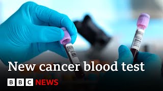 Blood test for more than 50 cancers ‘shows promise’ in study – BBC News