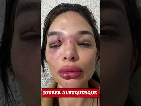 Violência doméstica: o perigo mora ao lado #alerta #justica #<strong>180</strong>