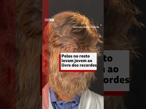 Guinness: adolescente entra no livro dos recordes por causa dos pelos faciais #bbcnewsbrasil