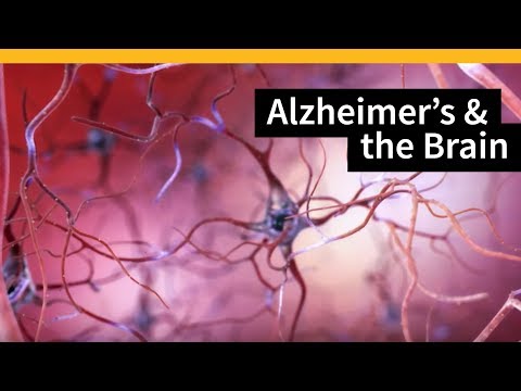 Upload mp3 to YouTube and audio cutter for How Alzheimer's Changes the Brain download from Youtube