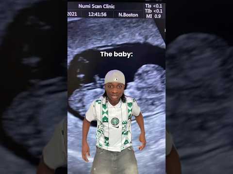 Mention a Dancer that disturb his/her mom in the womb 😂🕺🏽💃🏽 #shorts