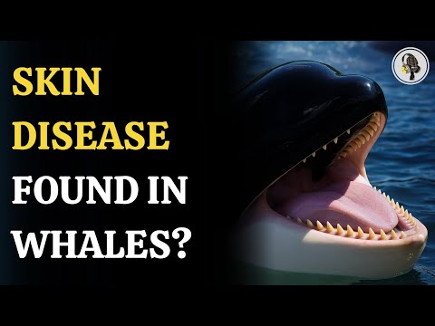 Skin Disease Rising in Killer Whales Alarms Experts | WION Podcast