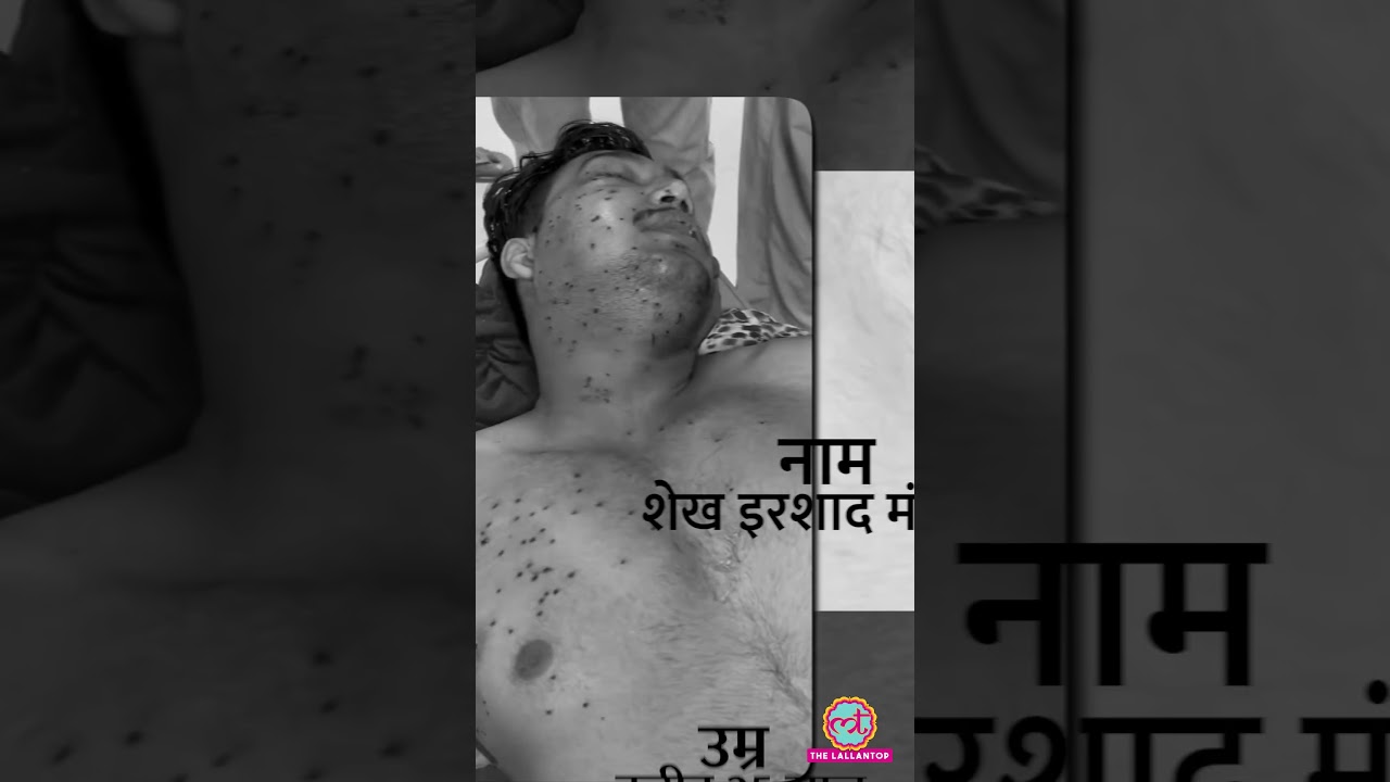 Jantar Mantar पर Pellet Gun विवाद: Delhi Police ने क्या किया? क्या हैं Guidelines? | #shorts