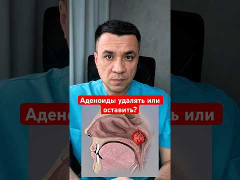 Аденоиды удалять или оставить? ↙️