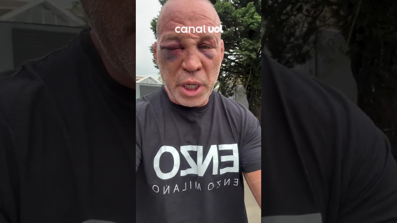 Wanderlei Silva promete ir à justiça por agressões sofridas em confusão Foi um ato criminoso