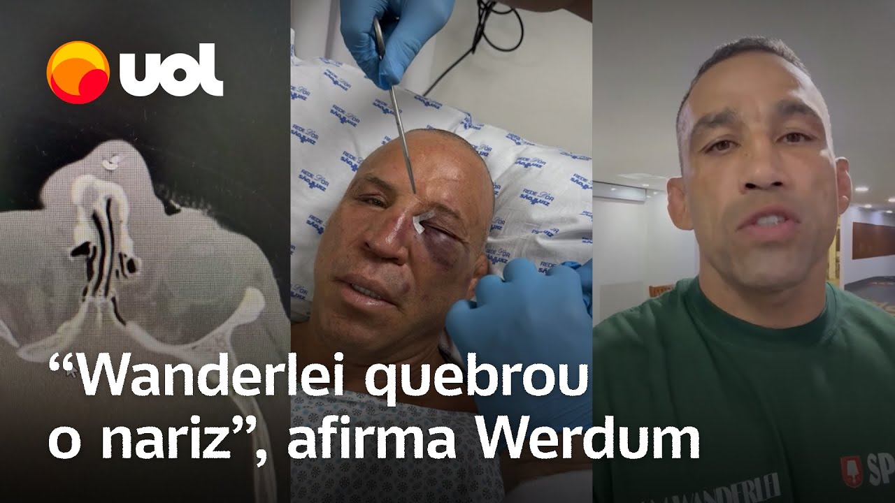 Werdum detona equipe do Popó e revela que Wanderlei Silva quebrou o nariz; veja vídeo