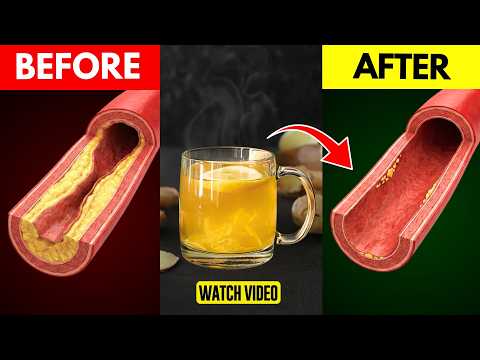 Only a Glass of This Drink Before Breakfast Unclog Arteries & Control High Blood Pressure