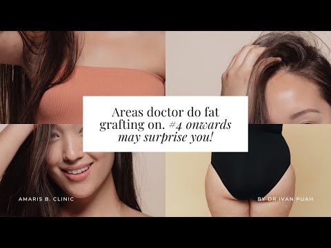 Areas doctor do fat grafting on. #4 onwards may surprise you! | Amaris B. Clinic by Dr Ivan Puah