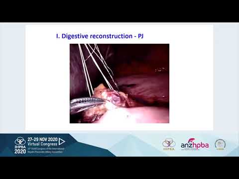 MTP14 - Robotic Pancreas Resections