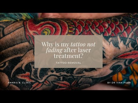 Why is my tattoo not fading after laser treatment? | Amaris B. Clinic by Dr Ivan Puah