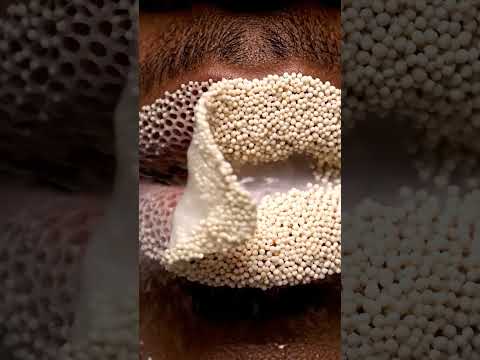 Elite ASMR | Smooth Lip Skin Peel Transformation | Extreme Trypophobia Reveal