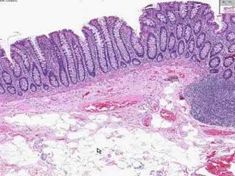 Histología De Colon (www.hhibarra.com) - YouTube