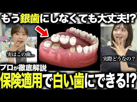 【銀歯が白くできる!?】6月から奥歯の“白いブリッジ”が保険適用に!対象者と注意点を歯医者が解説