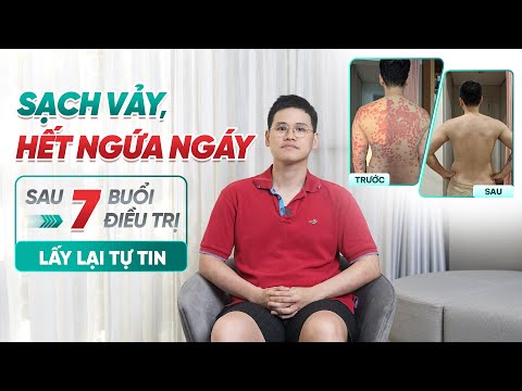 Sạch vảy, hết ngứa: Lấy lại tự tin sau 7 buổi điều trị vẩy nến