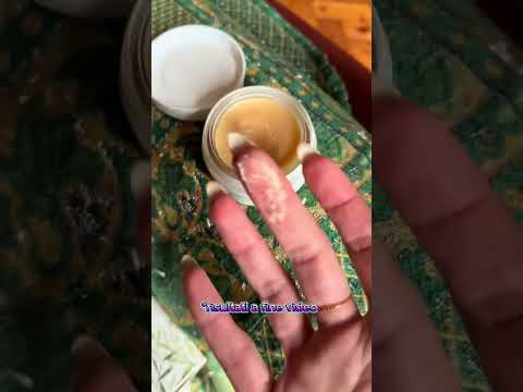 Psoriasi: risultati prima e dopo mamma Anita