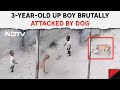Dog Attack Baby | 3-year-Old UP Boy Brutally Attacked By Dog, Hospitalised