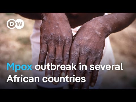 WHO declares global public health emergency following Mpox outbreak | DW News