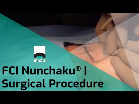 FCI Nunchaku® | Self-Retaining Bicanalicular Nasolacrimal Intubation | FCI Lacrimal