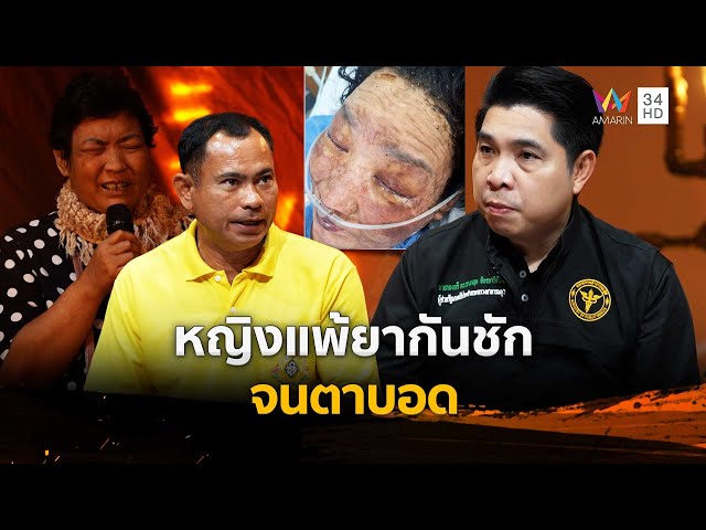 หญิงแพ้ยากันชัก จนตาบอด | ร่วมด้วยช่วยสู้ | 6 ก.ค. 68