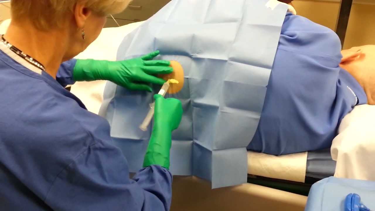 bone-marrow-biopsy-live-video-youtube