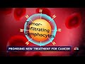 New Treatment Could Help Melanoma Patients  - 01:59 min - News - Video