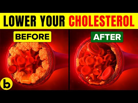 8 видови храна што можат да го намалат холестеролот