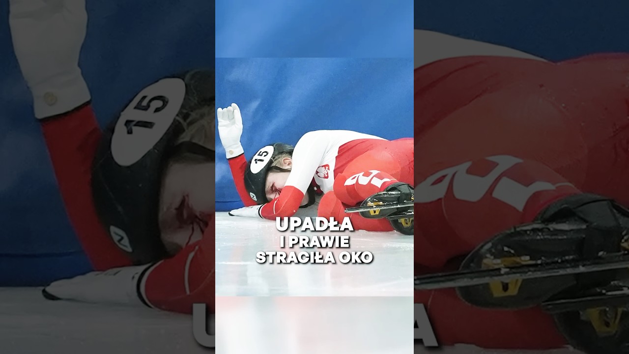 Upadła i niemal straciła oko. mamy najnowsze informacje #shorts